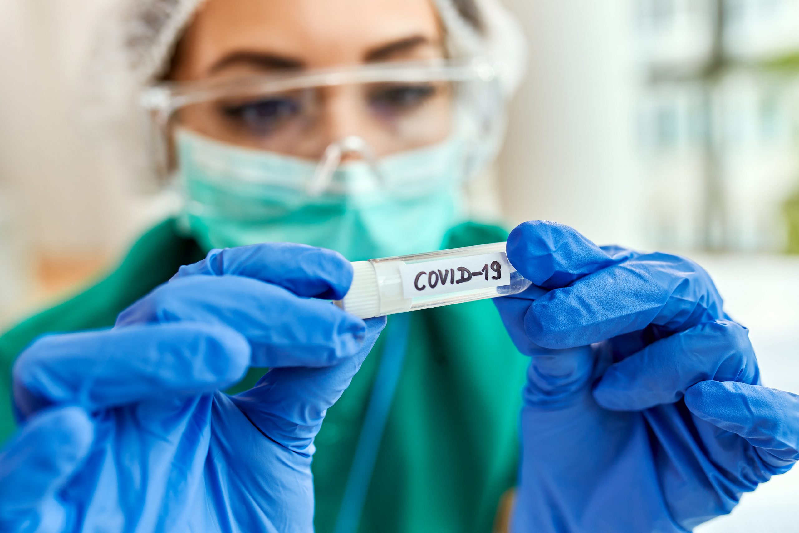 COVID-19 Pandemisi Hakkında Öneri ve Taleplerimiz